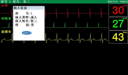 emWin监护仪界面设计，含uCOS-III和FreeRTOS两个版本