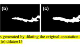 论文阅记 Segmentation-Based Deep-Learning Approach for Surface-Defect