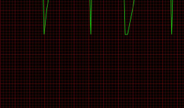 iOS 简单的使用drawRect 绘制