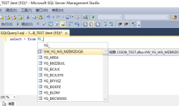 sqlServer自动代码提示功能